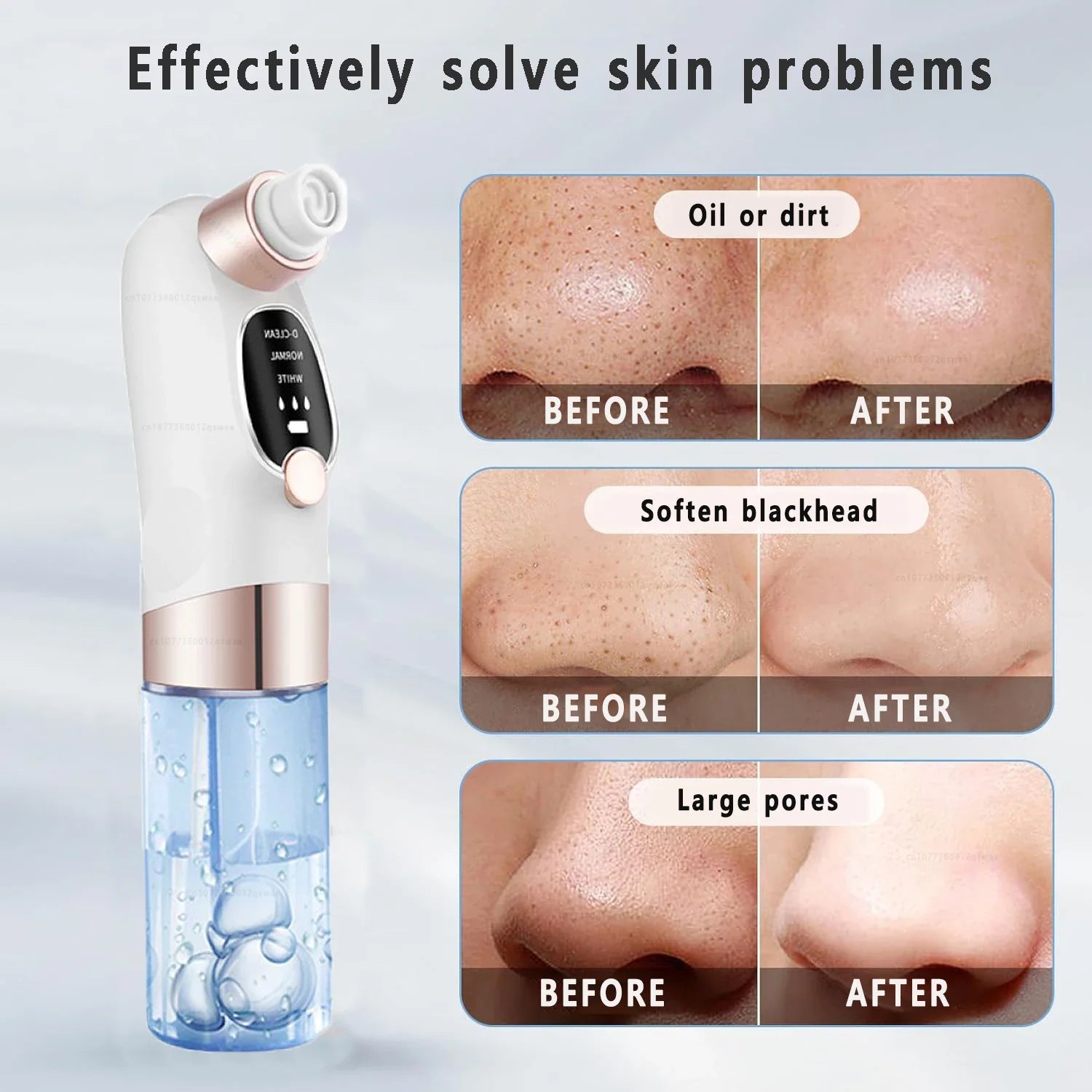 Electric Blackhead Remover Vacuum - Pore Face Cleaner